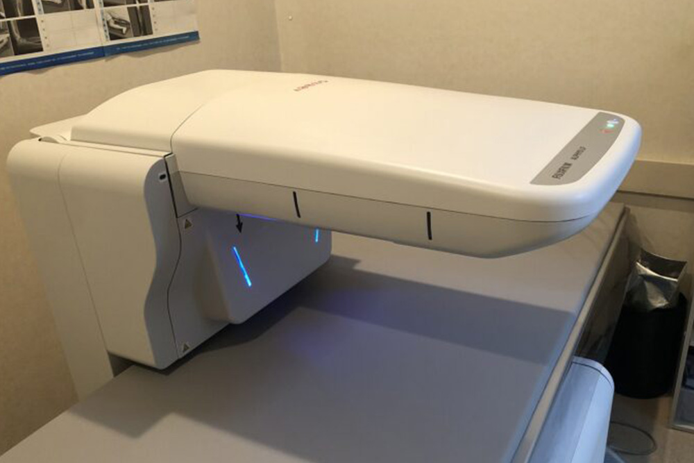 骨密度測定器DXA腰椎股関節