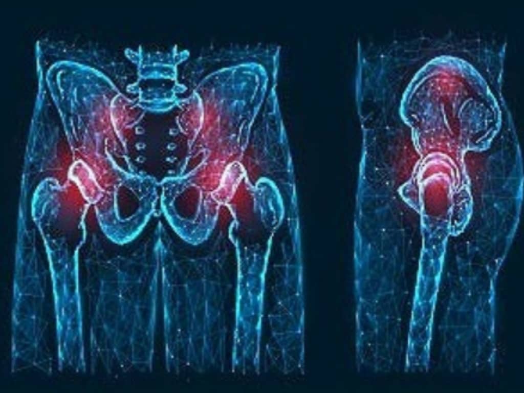 蕨セントラル整形外科｜DXA法による骨粗鬆症の骨密度検査イメージ